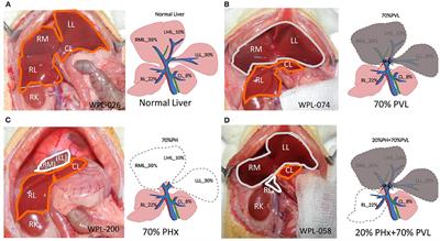 Hepatectomy-Induced Alterations in Hepatic Perfusion and Function - Toward Multi-Scale Computational Modeling for a Better Prediction of Post-hepatectomy Liver Function